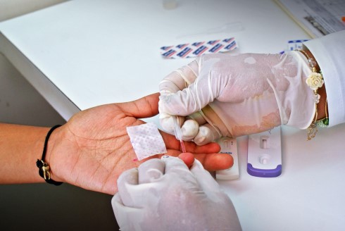 Destacan beneficios de tratamiento del VIH