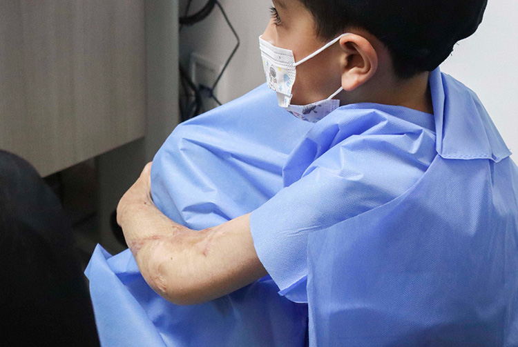 Los valorarán tras quemaduras 