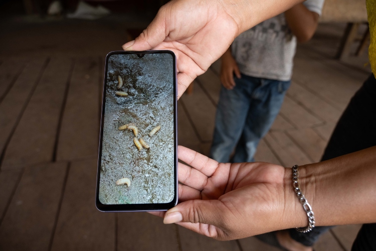  Ascienden a 21 los casos detectados de GBG en Jalisco