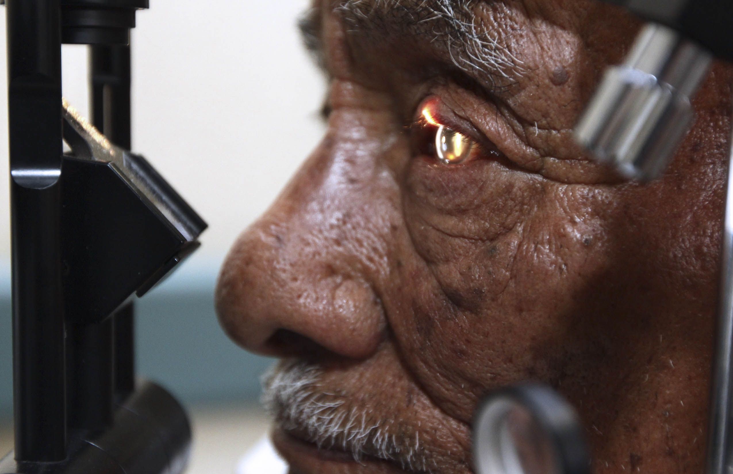 Reportan 542 cirugías oftalmológicas en Cruz Verde Sur en seis meses