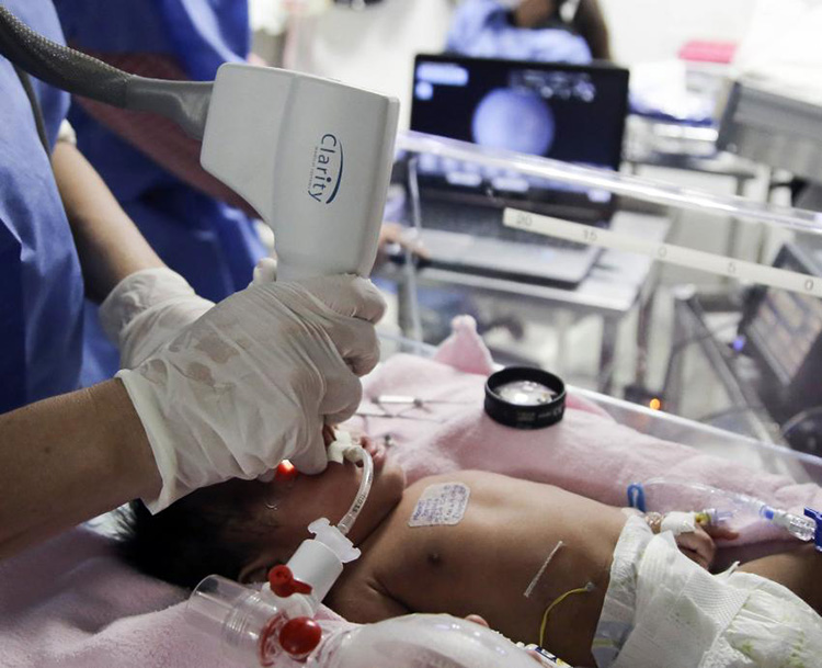HCG: 28 mil consultas por discapacidad visual