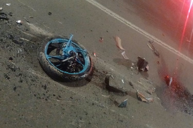 Joven sufre amputación parcial de ambas piernas tras choque en El Salto